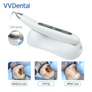 VVDental Dentistry Sonic Irrigator Endo Activator for Root Canal Cleaning And Calcified Stain Removal Dental Instrument Tools