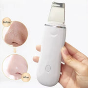 Home Blackhead Remover Blackhead Cleaning Pore Shrinking Beauty Device Dead Skin Acne Scalper Facial Pore Cleanser