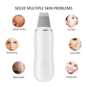 Home Blackhead Remover Blackhead Cleaning Pore Shrinking Beauty Device Dead Skin Acne Scalper Facial Pore Cleanser