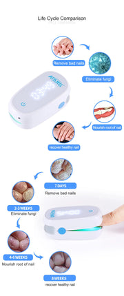 Toenail Fungus Nail Cleaning Laser device for onychomycosis 905nm laser 470nm blue light therapy nail fungus treatment