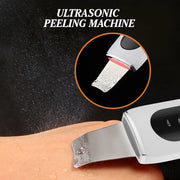 Ultrasoon reiniger Huidscrubber Peeling Mee-eter verwijderaar Diepe gezichtsreiniging Ultrasoon ionen Ance Pore Clean Gezichtsschepapparaat