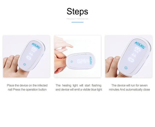 Toenail Fungus Nail Cleaning Laser device for onychomycosis 905nm laser 470nm blue light therapy nail fungus treatment