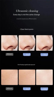 Blackhead Remover Blackhead Cleaning Pore Shrinking Beauty Device Dead Skin Acne Scalper Facial Pore Cleanser Beauty Equipment