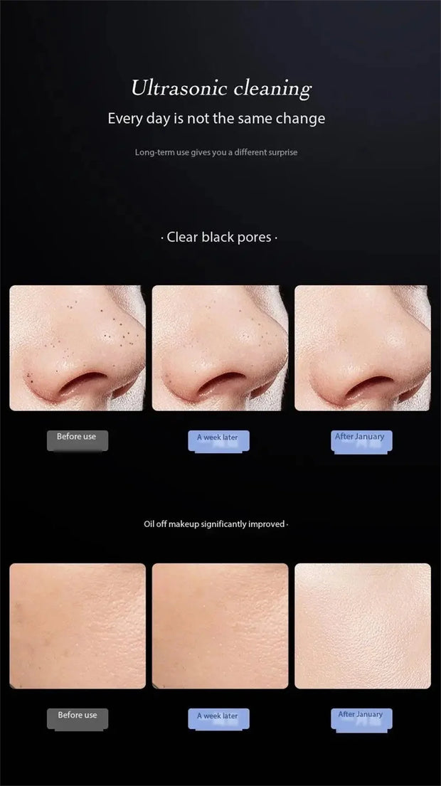 Blackhead Remover Blackhead Cleaning Pore Shrinking Beauty Device Dead Skin Acne Scalper Facial Pore Cleanser Beauty Equipment