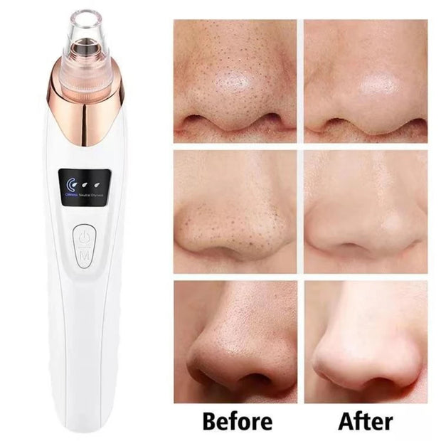 Electric Facial Blackhead Remover Vacuum Pore Cleaner Acne Cleanser Black Spots Removal Face Nose Deep Cleaning tools