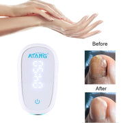 Toenail Fungus Nail Cleaning Laser device for onychomycosis 905nm laser 470nm blue light therapy nail fungus treatment