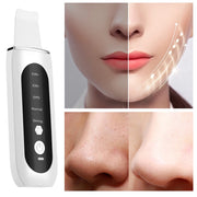 Ultrasoon reiniger Huidscrubber Peeling Mee-eter verwijderaar Diepe gezichtsreiniging Ultrasoon ionen Ance Pore Clean Gezichtsschepapparaat