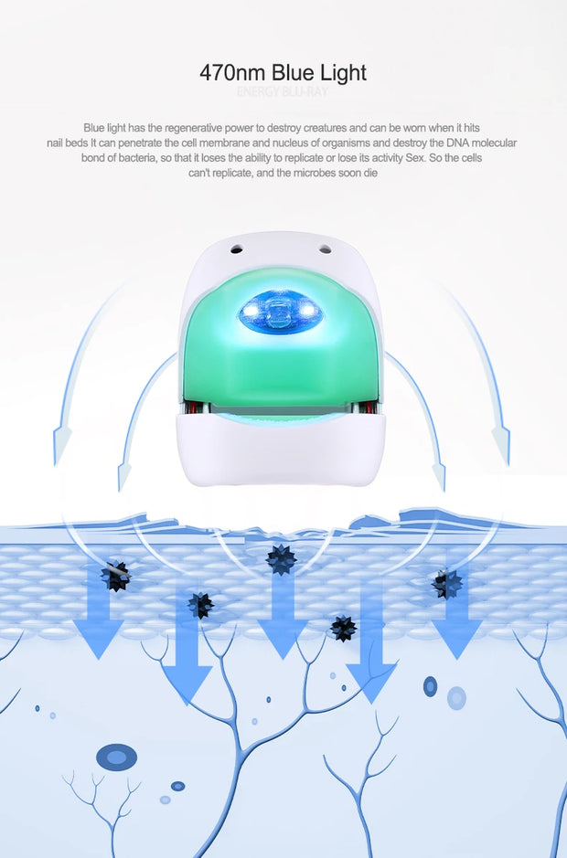 Toenail Fungus Nail Cleaning Laser device for onychomycosis 905nm laser 470nm blue light therapy nail fungus treatment